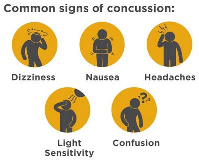 Common Concussion Symptoms