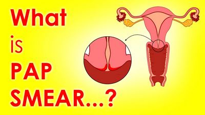 What is the Pap Smear?