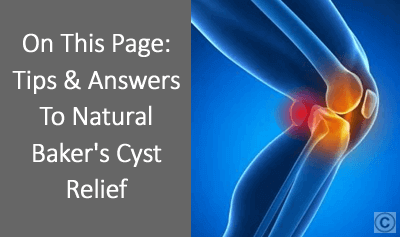 What Is the Treatment For Bakers Cyst?